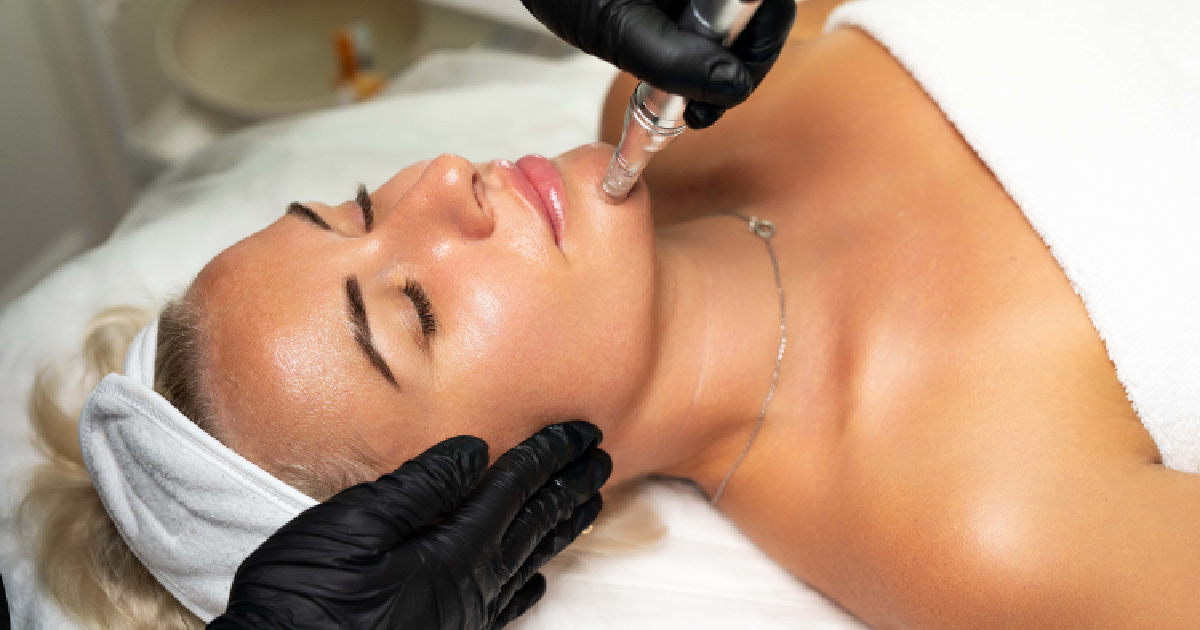 Woman getting a microneedling facial, eyes closed, as a technician uses a device on her chin in Texas