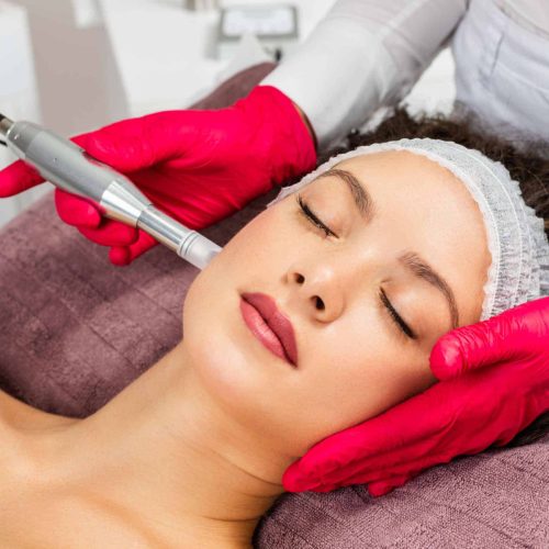 Microneedling in Houston, TX - My Face Lady