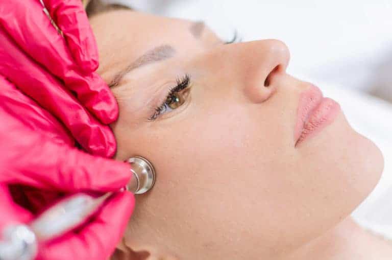 Microneedling Cure Pigmentation, Acne and Boost Collagen Production?