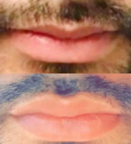 Lips